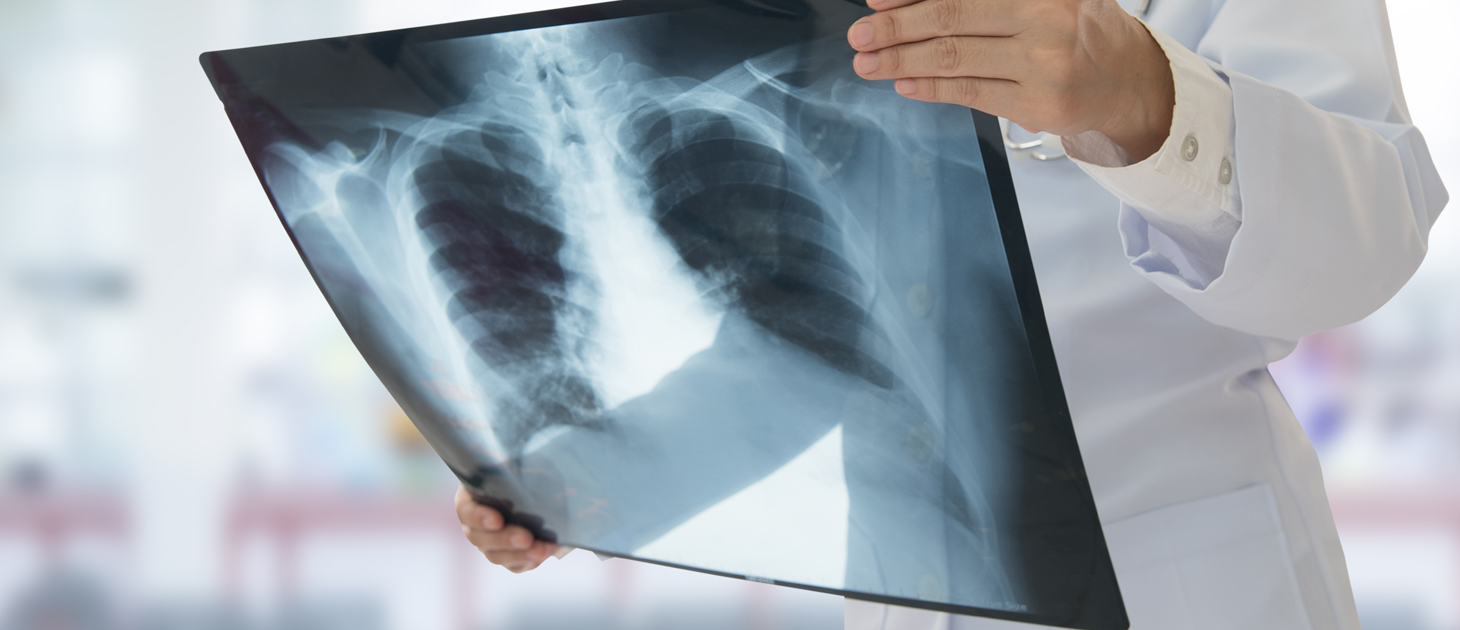 UBT, institucioni që përgatit ekspertët e radiologjisë